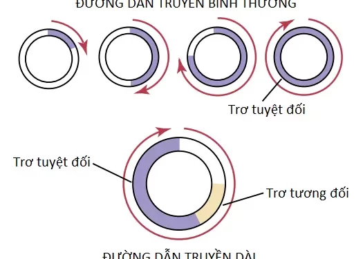 Các Loạn Nhịp Tim Và Điện Tâm Đồ Của Chúng (Phần 2)