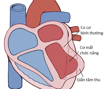 Tuần Hoàn Mạch Vành Và Bệnh Tim Thiếu Máu (Phần 2)