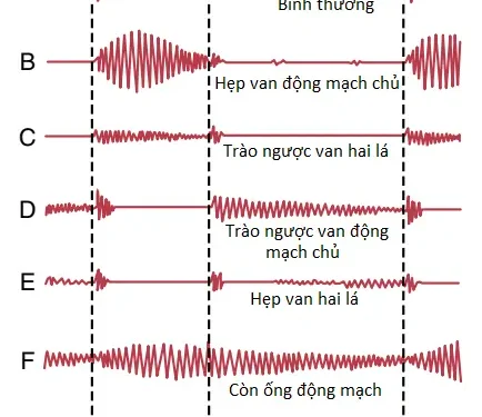 Các Van Tim Và Các Tiếng Tim; Các Khiếm Khuyết Van Tim Và Tim Bẩm Sinh (Phần 1)