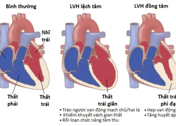 Các Van Tim Và Các Tiếng Tim; Các Khiếm Khuyết Van Tim Và Tim Bẩm Sinh (Phần 2)