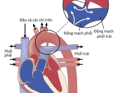 Các Van Tim Và Các Tiếng Tim; Các Khiếm Khuyết Van Tim Và Tim Bẩm Sinh (Phần 3)