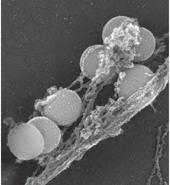 Viêm Cấp Tính (Phần 3)