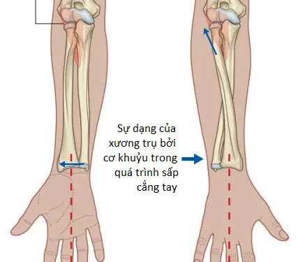 Giải Phẫu Vùng Chi Trên: Cẳng Tay (Phần 1)