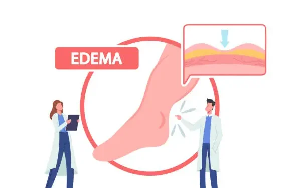 Các Thành Phần Dịch Cơ Thể: Các Dịch Ngoại Bào Và Nội Bào; Phù (Phần 4)