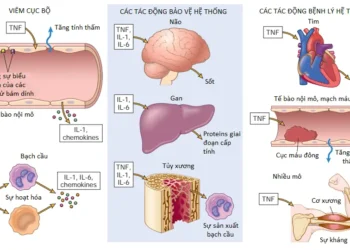 Viêm Cấp Tính (Phần 5)
