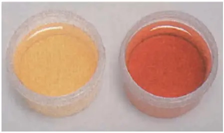 porphyrias-2