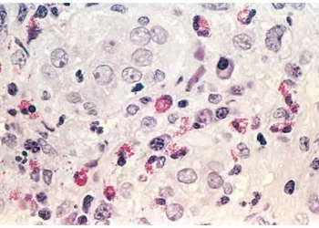 Viêm Và Sự Sửa Chữa (Phần 8)