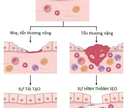 Viêm Và Sự Sửa Chữa (Phần 9)