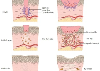 Viêm Và Sự Sửa Chữa (Phần 11)